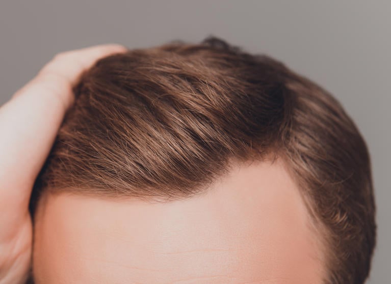 capelli sani e idratati